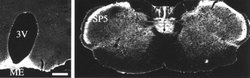 SSTR1 Polyclonal Antibody:Antibodies, Polyclonal