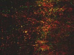SSTR1 Polyclonal Antibody:Antibodies, Polyclonal