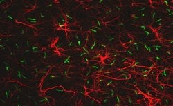 Invitrogen SSTR3 Polyclonal Antibody 100 &mu;L; Unconjugated:Antibodies,