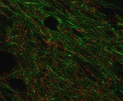 SSTR4 Polyclonal Antibody