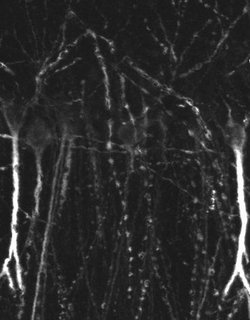 SSTR4 Polyclonal Antibody:Antibodies, Polyclonal