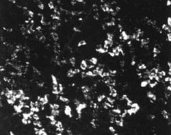 Invitrogen™ SSTR5 Polyclonal Antibody
