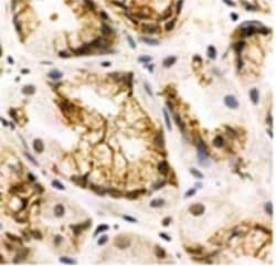 Invitrogen™ SSTR1 Polyclonal Antibody