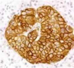 Invitrogen SSTR2 Polyclonal Antibody 100 &mu;L; Unconjugated:Antibodies,