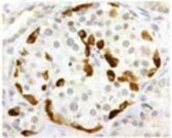 Invitrogen™ SSTR3 Polyclonal Antibody
