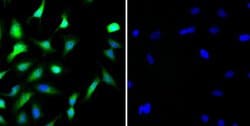 Invitrogen STAT1 Monoclonal Antibody (C.156.9) 100 &mu;L; Unconjugated:Antibodies,