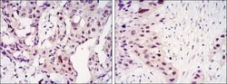 Invitrogen STAT3 Monoclonal Antibody (3B5) 100 &mu;L; Unconjugated:Antibodies,