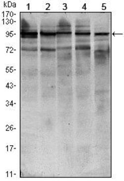 Invitrogen STAT6 Monoclonal Antibody (7D3) 100 &mu;L | Buy Online | Invitrogen&trade; | Fisher Scientific