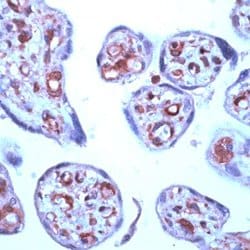 Invitrogen STAT6 Polyclonal Antibody:Antibodies:Primary Antibodies