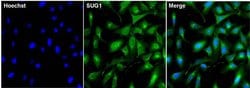 Invitrogen&trade;&nbsp;PSMC5 Monoclonal Antibody (2SU-1B8)