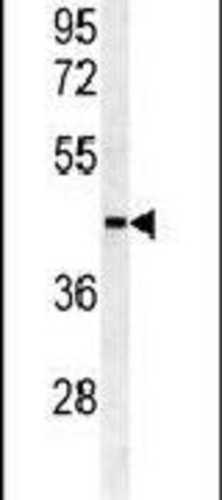 SULT2B1 Rabbit anti-Human, Polyclonal, Invitrogen 400 &mu;L; Unconjugated:Antibodies,