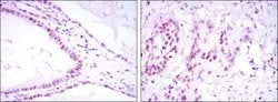 Invitrogen SUZ12 Monoclonal Antibody (3D10) 100 &mu;L; Unconjugated:Antibodies,
