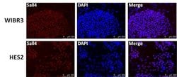 Invitrogen SALL4 Polyclonal Antibody 100 &mu;g; Unconjugated:Antibodies,