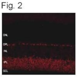 Invitrogen SHANK1 Polyclonal Antibody 100 &mu;g; Unconjugated:Antibodies,