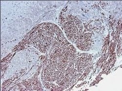 Invitrogen Smoothelin Monoclonal Antibody (R4A) 100 &mu;L; Unconjugated:Antibodies,