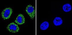 ATP1A1 Monoclonal Antibody (M7-PB-E9), Invitrogen 400 &mu;L; Unconjugated:Antibodies,