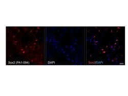 Invitrogen SOX2 Polyclonal Antibody:Antibodies:Primary Antibodies