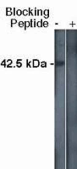 Invitrogen SPHK1 Polyclonal Antibody 100 &mu;g; Unconjugated:Antibodies,