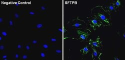 Invitrogen SFTPB Monoclonal Antibody (SPB02 (1B9)) 100 &mu;g; Unconjugated:Antibodies,