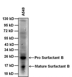 Invitrogen SFTPB Monoclonal Antibody (SPB02 (1B9)) 100 &mu;g; Unconjugated:Antibodies,