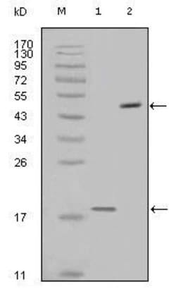 Invitrogen Survivin Monoclonal Antibody (2H5H2) 100 &mu;L; Unconjugated:Antibodies,