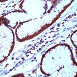 Survivin Rabbit anti-Human, Polyclonal, Invitrogen 500 &mu;L; Unconjugated:Antibodies,