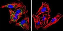 Invitrogen SNTB2 Monoclonal Antibody (1351) 100 &mu;g; Unconjugated:Antibodies,