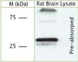 Synaptophysin Polyclonal Antibody, Invitrogen 100 &mu;L; Unconjugated:Anticorps,