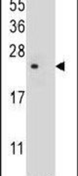 TM4SF4 Rabbit anti-Human, Mouse, Polyclonal, Invitrogen 400 μL; Unconjugated:Antibodies,