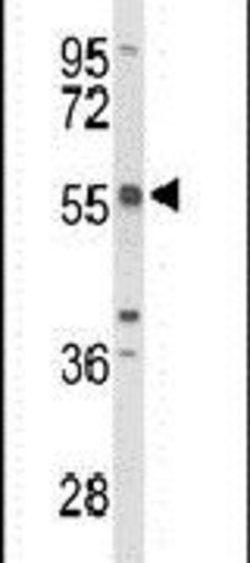 TC2N Rabbit anti-Human, Mouse, Polyclonal, Invitrogen 400 &mu;L; Unconjugated:Antibodies,