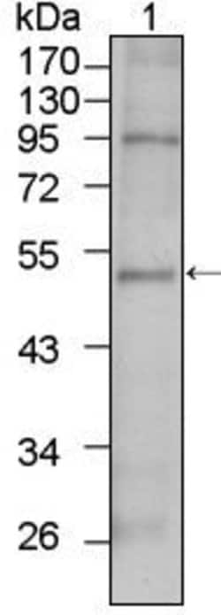 Invitrogen TBX5 Monoclonal Antibody (7B11) 100 &mu;L; Unconjugated:Antibodies,