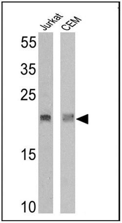 Invitrogen TCR V delta 2 Monoclonal Antibody (15D) 200 &mu;g; Unconjugated:Antibodies,