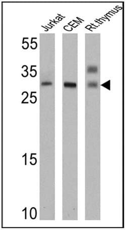 Invitrogen TCR V alpha 12.1 Monoclonal Antibody (6D6.6) 200 &mu;g; Unconjugated:Antibodies,