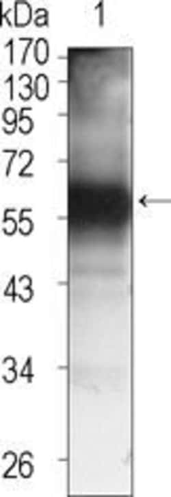 Invitrogen TEC Monoclonal Antibody (3A5) 100 &mu;L | Buy Online | Invitrogen&trade; | Fisher Scientific