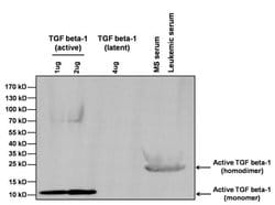 Invitrogen™ TGF beta-1 Polyclonal Antibody