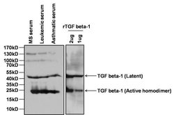 Invitrogen TGF beta-1 Monoclonal Antibody (B11-4C3) 200 &mu;g; Unconjugated:Antibodies