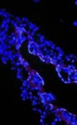 Invitrogen TGF beta-3 Polyclonal Antibody 250 &mu;g; Unconjugated:Antibodies,