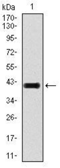 LAP (Latency Associated Peptide) Monoclonal Antibody (7F6):Antibodies,