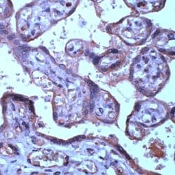 Invitrogen TIMP3 Polyclonal Antibody:Antibodies:Primary Antibodies