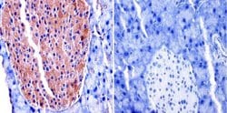 Invitrogen TIMP2 Monoclonal Antibody (F27 P3 A4) 100 &mu;g; Unconjugated:Antibodies,