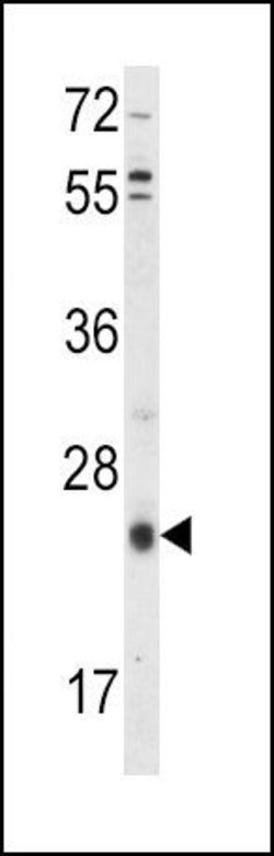TIMP3 Rabbit anti-Human, Mouse, Polyclonal, Invitrogen 400 &mu;L; Unconjugated:Antibodies,