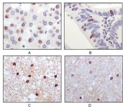 Invitrogen TIP60 Monoclonal Antibody (3F9) 100 &mu;L; Unconjugated:Antibodies,