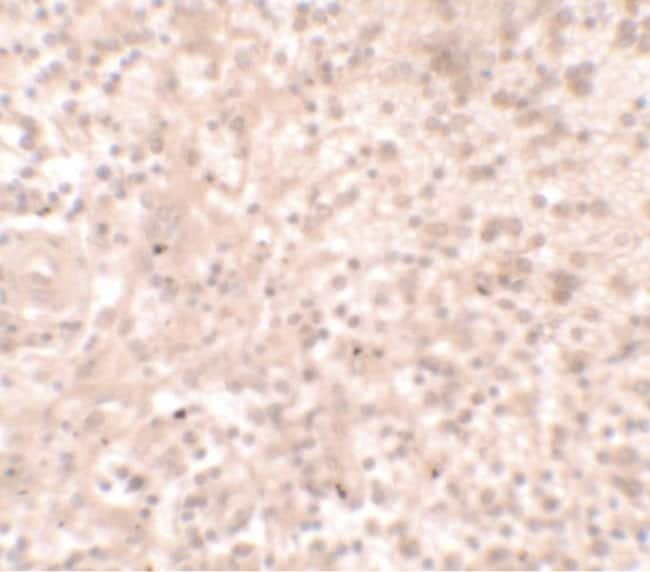 TLX1 Polyclonal Antibody, Invitrogen™ 100 μg; Unconjugated Primary ...