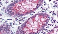 TMPRSS4 Polyclonal Antibody, Invitrogen 50 &mu;g; Unconjugated:Antibodies,