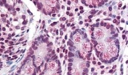 TMPRSS4 Polyclonal Antibody, Invitrogen 50 &mu;g; Unconjugated:Antibodies,