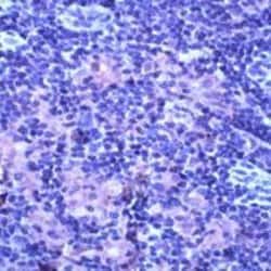 Invitrogen TNFR2 Polyclonal Antibody 1 mL; Unconjugated:Antibodies, Polyclonal