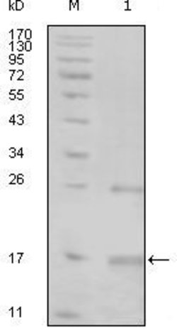 Invitrogen TNK1 Monoclonal Antibody (1B5G3;3F11H6) 100 &mu;L; Unconjugated:Antibodies,