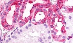 TPRA1 Polyclonal Antibody, Invitrogen 50 &mu;g; Unconjugated:Antibodies,