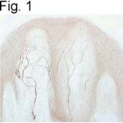 Invitrogen TRPV1 Polyclonal Antibody 100 &mu;g; Unconjugated:Antibodies,