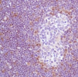 TdT Polyclonal Antibody, Invitrogen 500 &mu;L | Buy Online | Invitrogen | Fisher Scientific